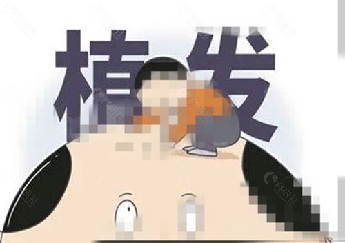 北海植发价格