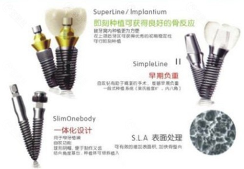 登腾种植牙为什么便宜