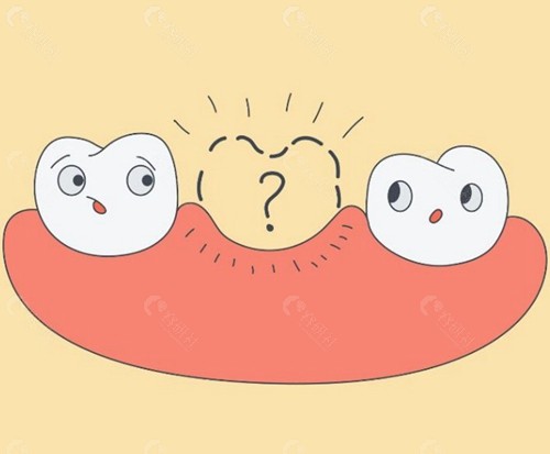 马里兰桥修复牙齿易掉吗？