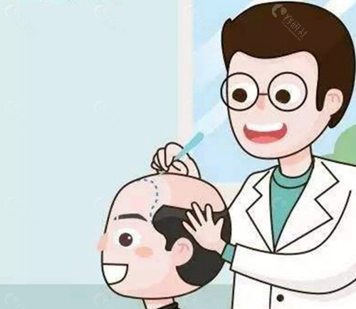 如何科学选择植发方案？