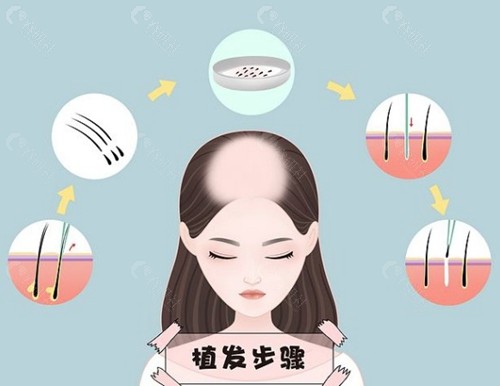 影响价格的四个关键因素
