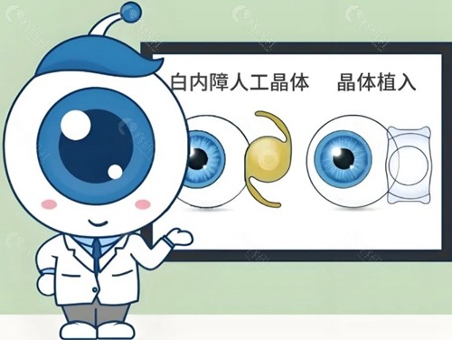 白内障手术价格
