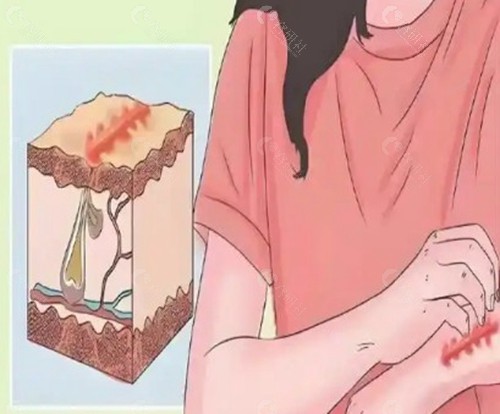 毛运春医生