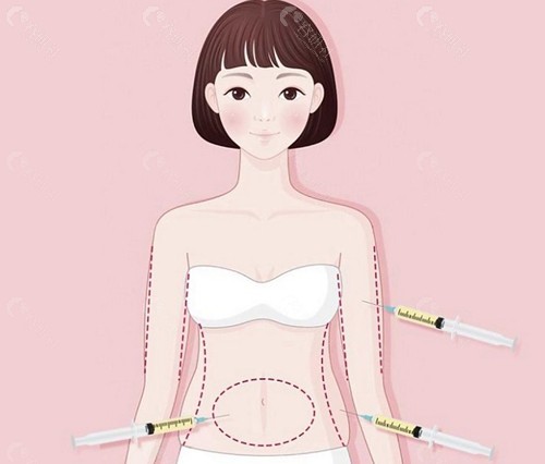 维密脂雕和黄金微雕收费价格差异分析