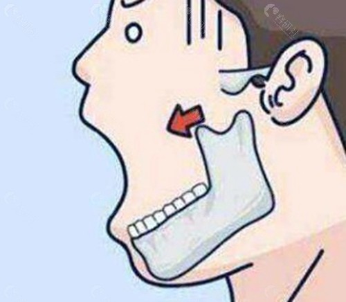 柳超医生