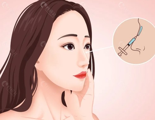 王棚隆鼻怎么样