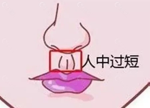 车卓如医生人中缩短好吗
