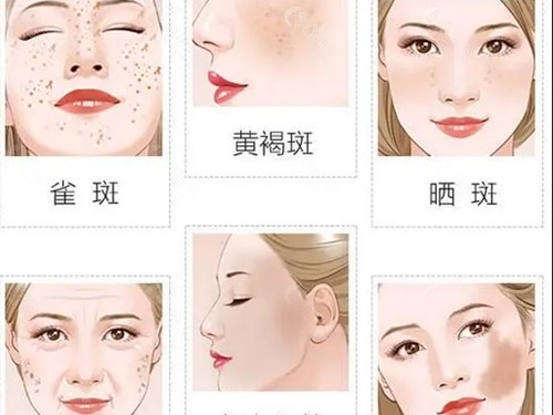 毕节爱侈医疗美容祛斑好吗