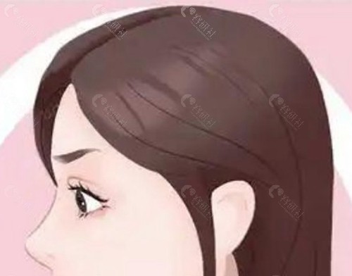 膨体材料