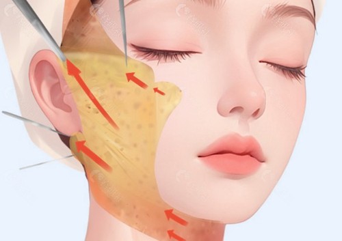 河东镐医生 河东镐医生