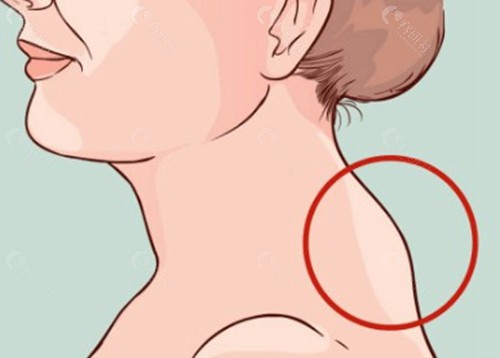 徐淑卿医生 徐淑卿医生