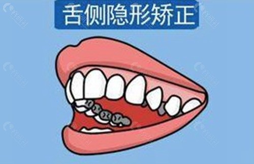 张栋梁医生 张栋梁医生