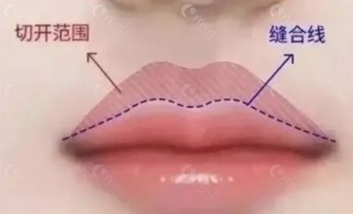 程晓林医生 程晓林医生