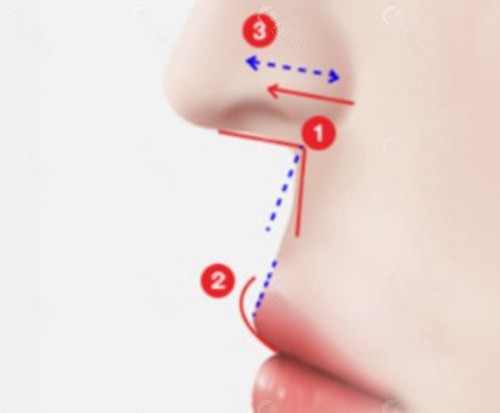 付毅医生 付毅医生