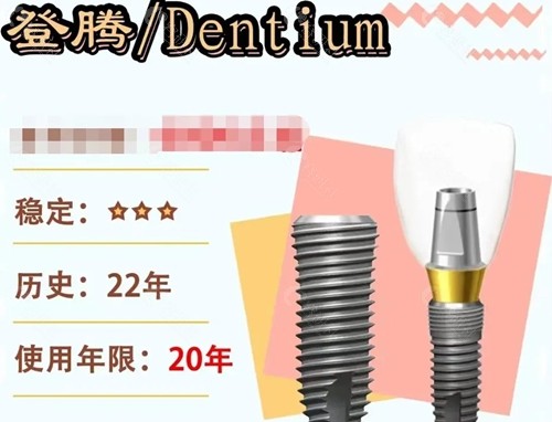 韩国登腾种植牙寿命多少 韩国登腾种植牙寿命多少