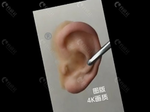 义耳价格 义耳价格