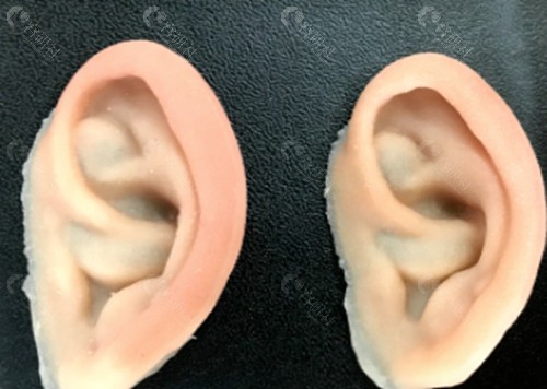 义耳的优缺点有哪些? 义耳的优缺点有哪些?