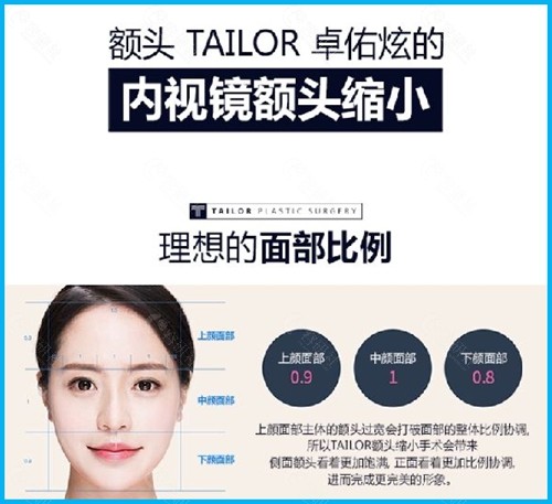 韩国TAILOR卓佑炫整形外科医院额头缩小手术优势