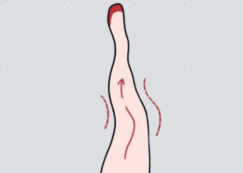 陈凯医生 陈凯医生