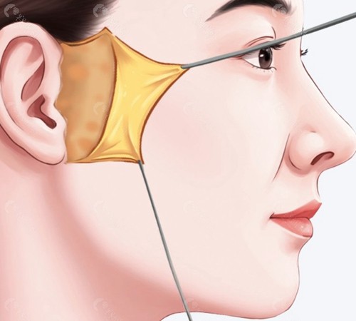 何一波医生 何一波医生