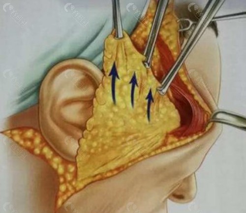 李富强医生 李富强医生