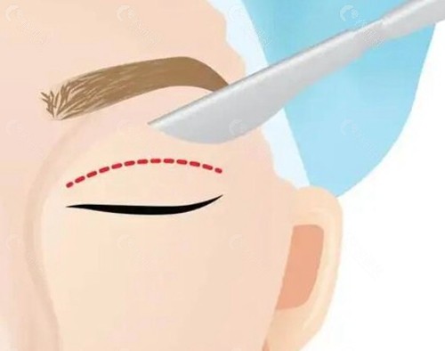 张霞飞医生 张霞飞医生