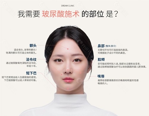 韩国梦想玻尿酸填充 韩国梦想玻尿酸填充