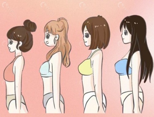 自体脂肪丰胸准备10万元够吗? 自体脂肪丰胸准备10万元够吗?