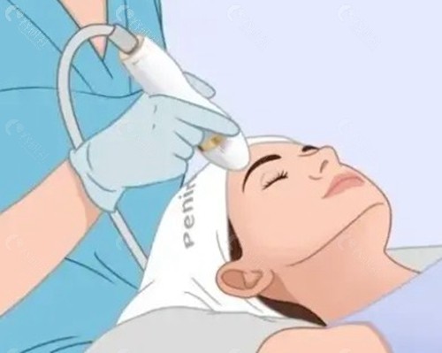 青岛做超声炮到底要花多少钱2026价格表