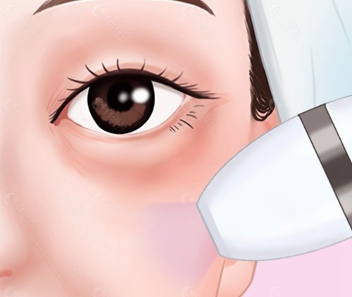 重庆超声炮做的好的医生及特色一览