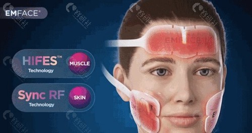 美菲斯面部抗衰价格是多少？