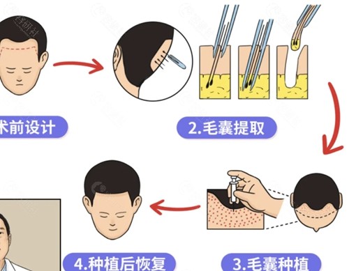 哈尔滨瑞丽诗植发怎么样