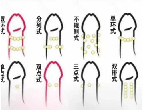 河南南阳天伦医院私密科做男科入珠手术怎么样
