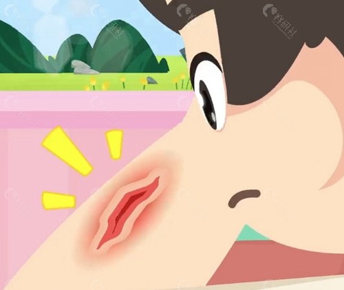柳晓杰医生