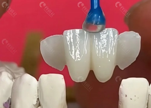 马里兰桥修复价格
