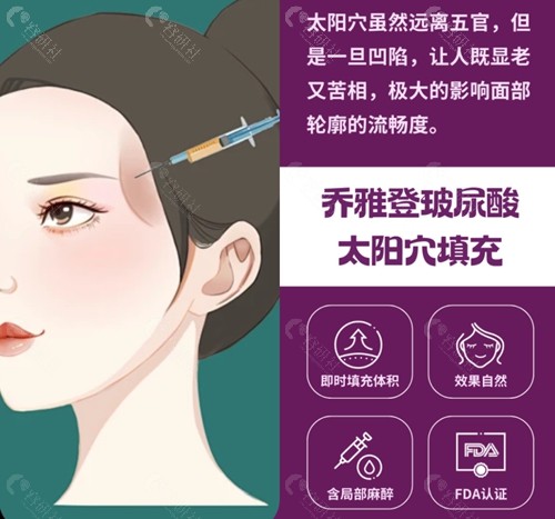 乔雅登玻尿酸注射填充太阳穴怎么样？