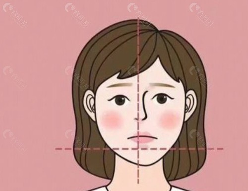 面部不对称矫正手术价格为7万元起。