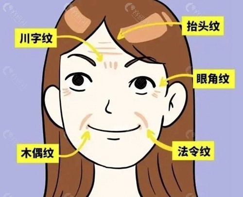 面部提升三件套到底包含哪三个项目？