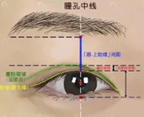 淮南星奂星医疗美容做双眼皮怎么样