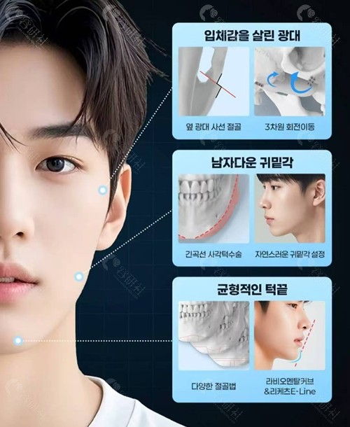韩国1%百分之一整形外科医院男士轮廓整形技术特点 韩国1%百分之一整形外科医院男士轮廓整形技术特点