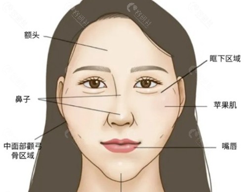 贴骨针和轻薄针的本质区别