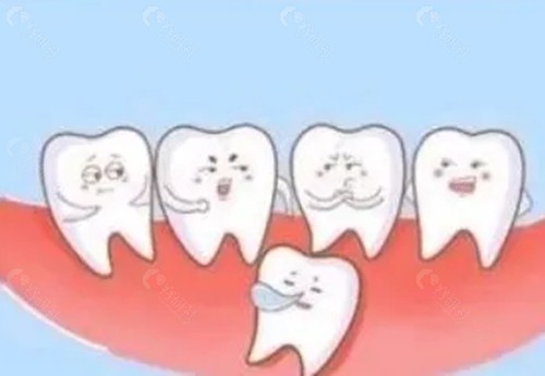 埋伏牙拔掉还是牵引好