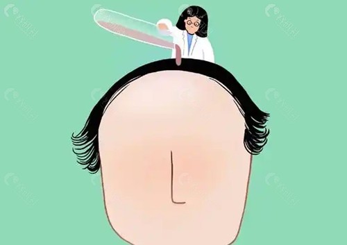青岛碧莲盛植发医生技术怎么样