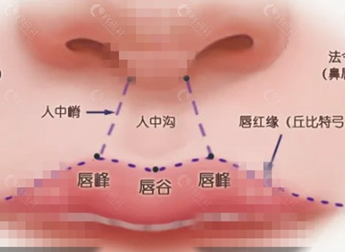 人中加深整形价格