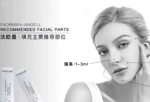 法欧曼玻尿酸多少钱