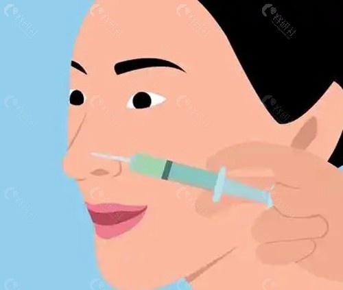  洪锡钟医生：精细技艺塑造自然美鼻