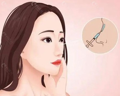  杨晓松医生：创新技术打造个性美鼻