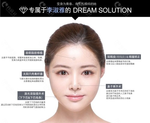 韩国梦想整形外科医院眼鼻综合整形+激光溶脂提升术方案设计