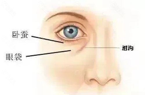 林广兴医生去眼袋好吗