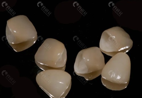 进口全瓷牙冠多少钱一颗
